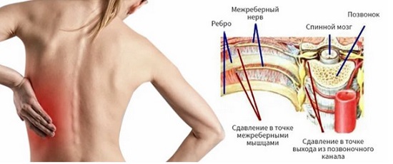 Болит позвоночник посередине спины