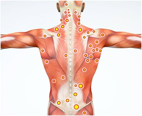 Болят мышцы спины вдоль позвоночника