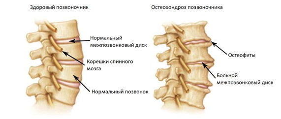 Причины болей в спине у мужчин