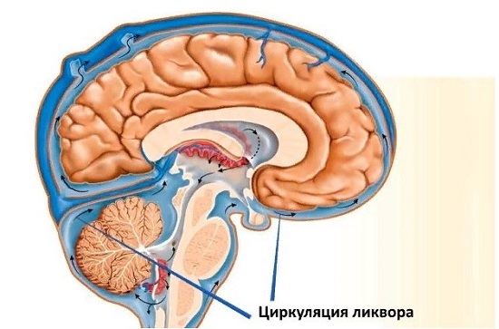 Давление внутри черепа повышается по двум причинам: ликвор производится в избытке или он хуже оттекает